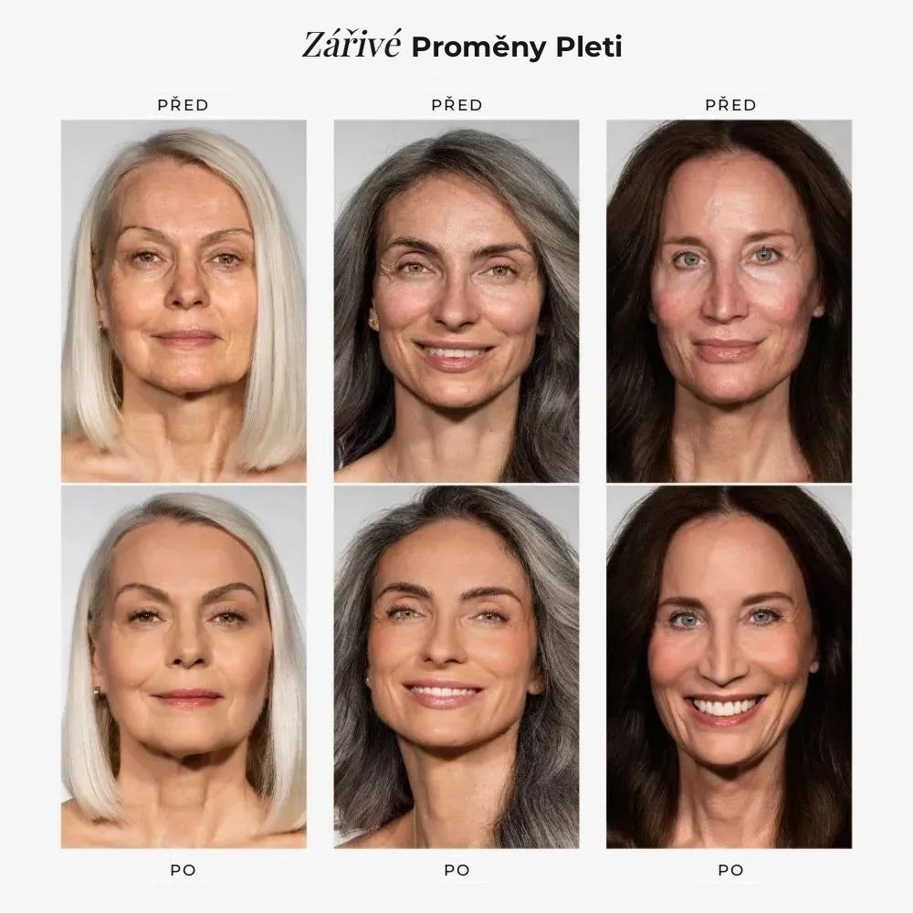 Zářivé proměny pleti – před a po
